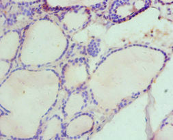 HAS3 Antibody