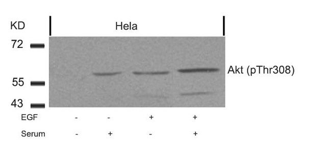 Phospho-AKT1 (Thr308) Antibody