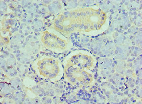 HDAC8 Antibody