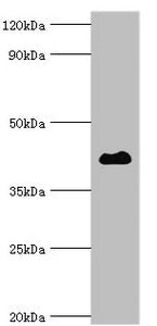 HDAC8 Antibody