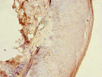 HEMK1 Antibody