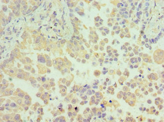 N6AMT1 Antibody