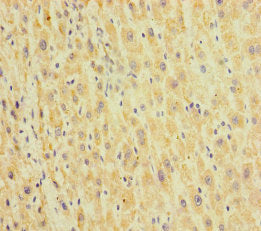 HEPACAM2 Antibody