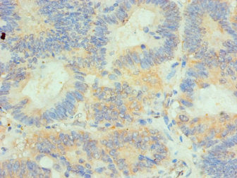 HIP1 Antibody