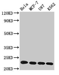 HIST1H1B (Ab-16) Antibody