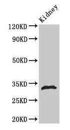 Phospho-HIST1H1B (S188) Antibody