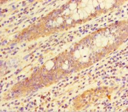 HIST1H1C Antibody