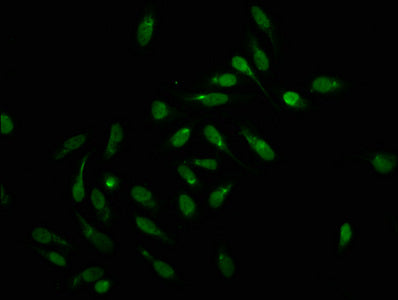 Formyl-HIST1H1C (K159) Antibody