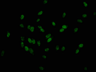 Phospho-HIST1H1D (T179) Antibody