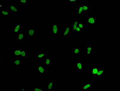 HIST1H1E (Ab-51) Antibody