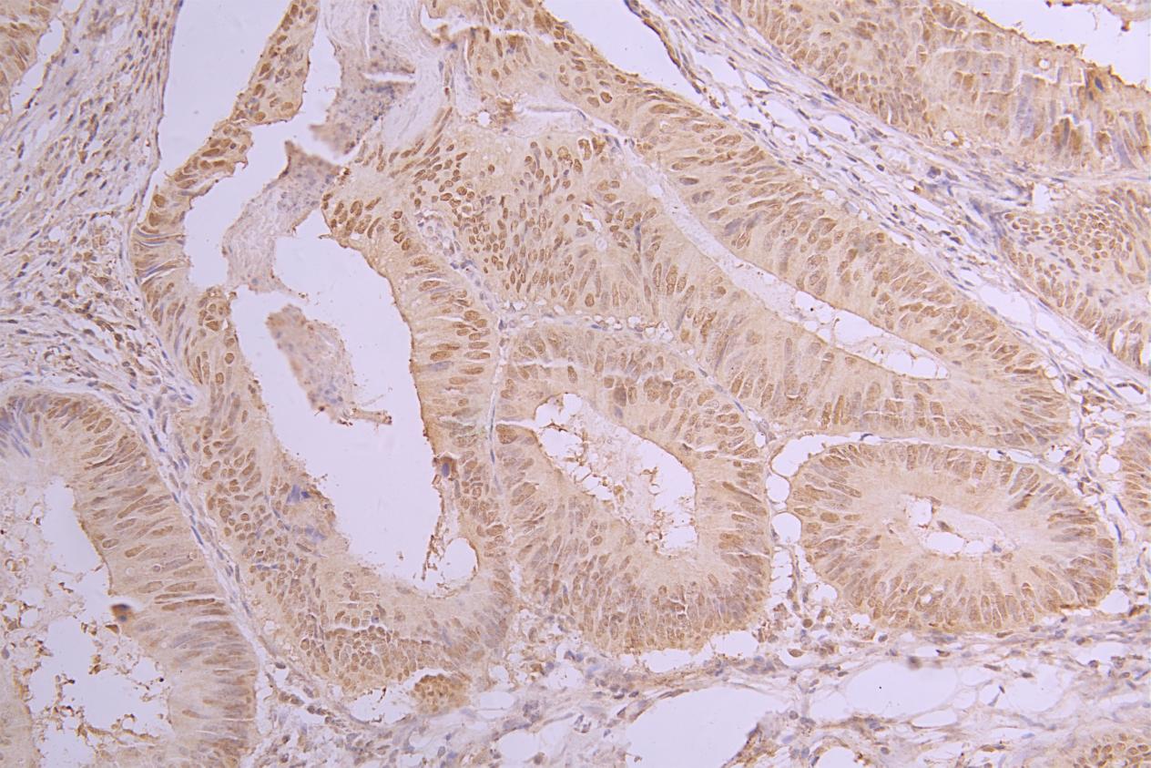 HIST1H2BB (Ab-5) Antibody