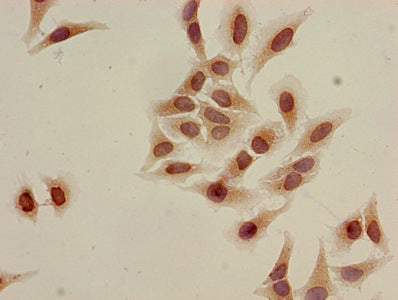 Acetyl-HIST1H3A (K9) Antibody