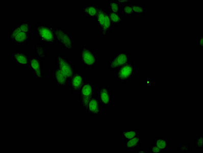 Mono-methyl-HIST1H3A (R17) Antibody