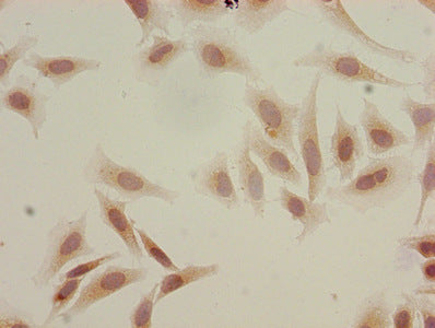 Acetyl-HIST1H3A (K18) Antibody