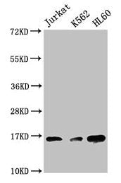 Tri-methyl-HIST1H3A (K27) Antibody