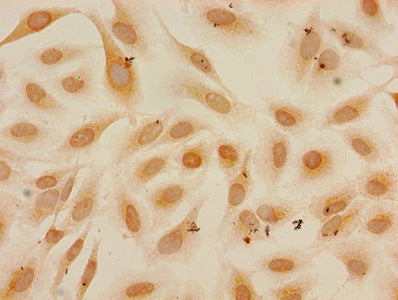 Mono-methyl-HIST1H3A (K27) Antibody