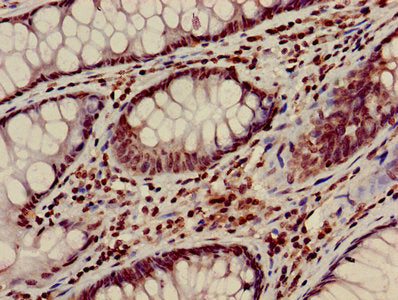 HIST1H3A (Ab-28) Antibody