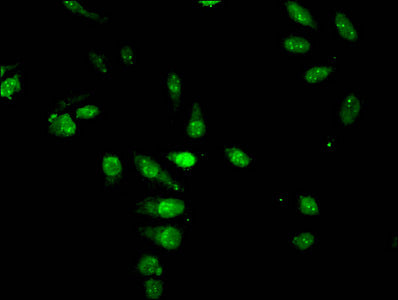 Acetyl-HIST1H4A (K5) Antibody