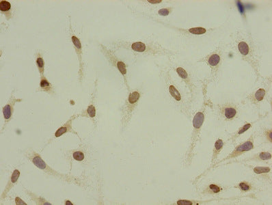 Acetyl-HIST1H4A (K8) Antibody