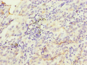 HK3 Antibody