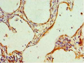 HMGN4 Antibody