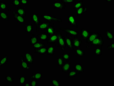 HNRNPA1 Antibody