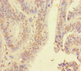 HNRNPA2B1 Antibody