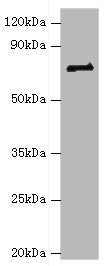 HNRNPM Antibody
