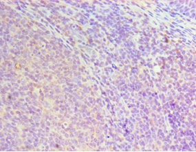 HOXA1 Antibody
