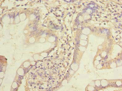 HOXC11 Antibody