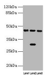 HPD Antibody