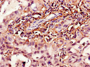 HPGD Antibody