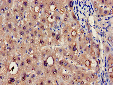 RIDA Antibody