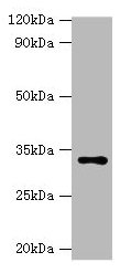 HSD11B1 Antibody