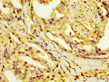 HSD17B1 Antibody