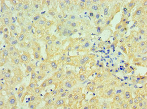 HSD17B4 Antibody