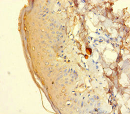 HTR2A Antibody