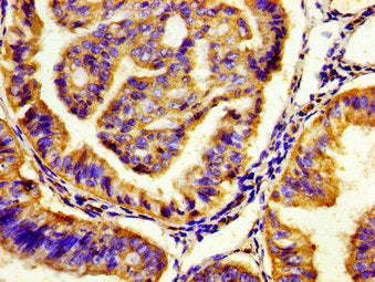 HTR7 Antibody