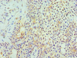 HYAL3 Antibody
