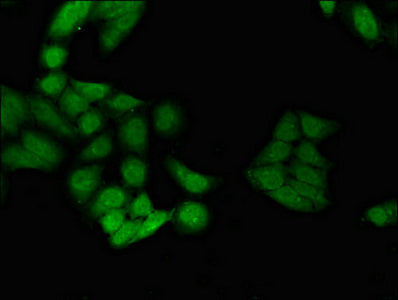 ID4 Antibody