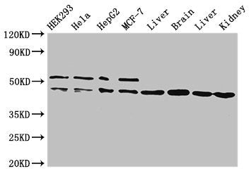 IDH1 Antibody