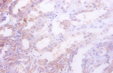 Idh1 Antibody