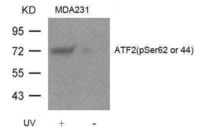 Phospho-ATF2 (Ser62 or 44) Antibody