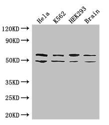 IGF2BP3 Antibody
