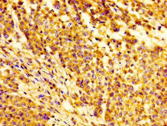 IGFBP6 Antibody