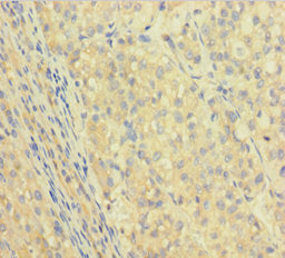 IGHG1 Antibody