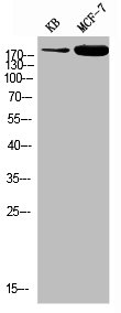 Phospho-IRS1 (Y896) Antibody