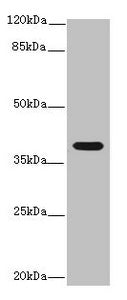 IL12B Antibody