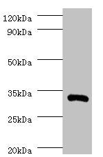 IL1B Antibody