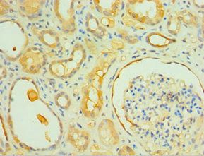 IL1R1 Antibody